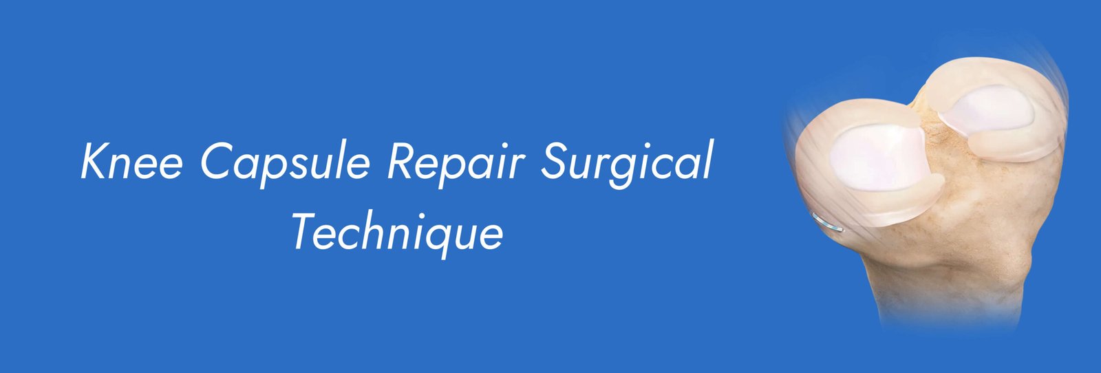 Knee Capsule Repair Surgical Technique