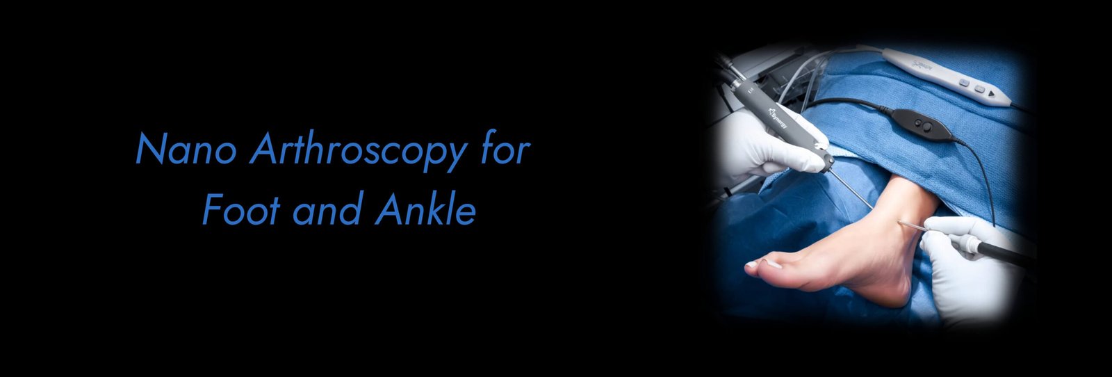 Nano Arthroscopy for Foot and Ankle