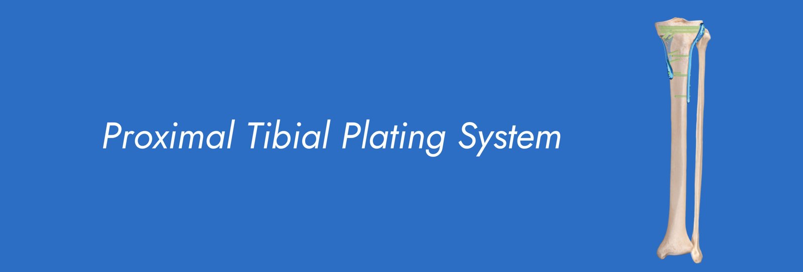 Proximal Tibial Plating System