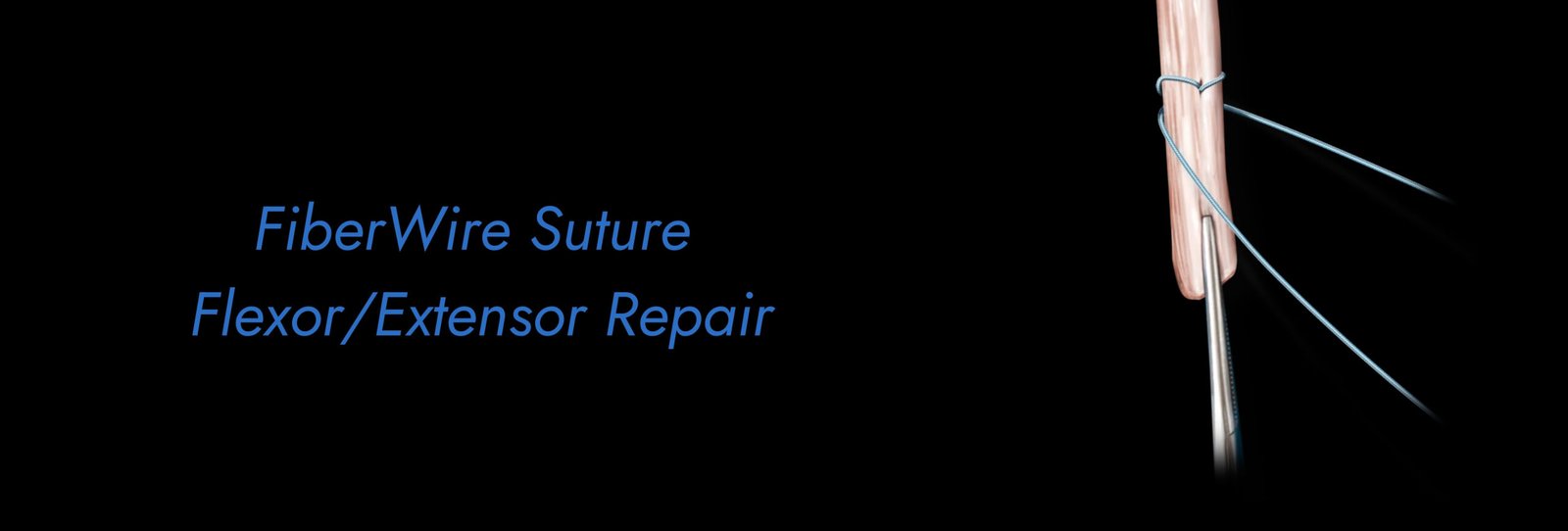 FiberWire Suture Flexor_Extensor Repair